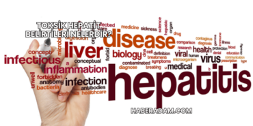 Toksik Hepatit Belirtileri Nelerdir?