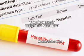 Toksik Hepatit Belirtileri Nelerdir?
